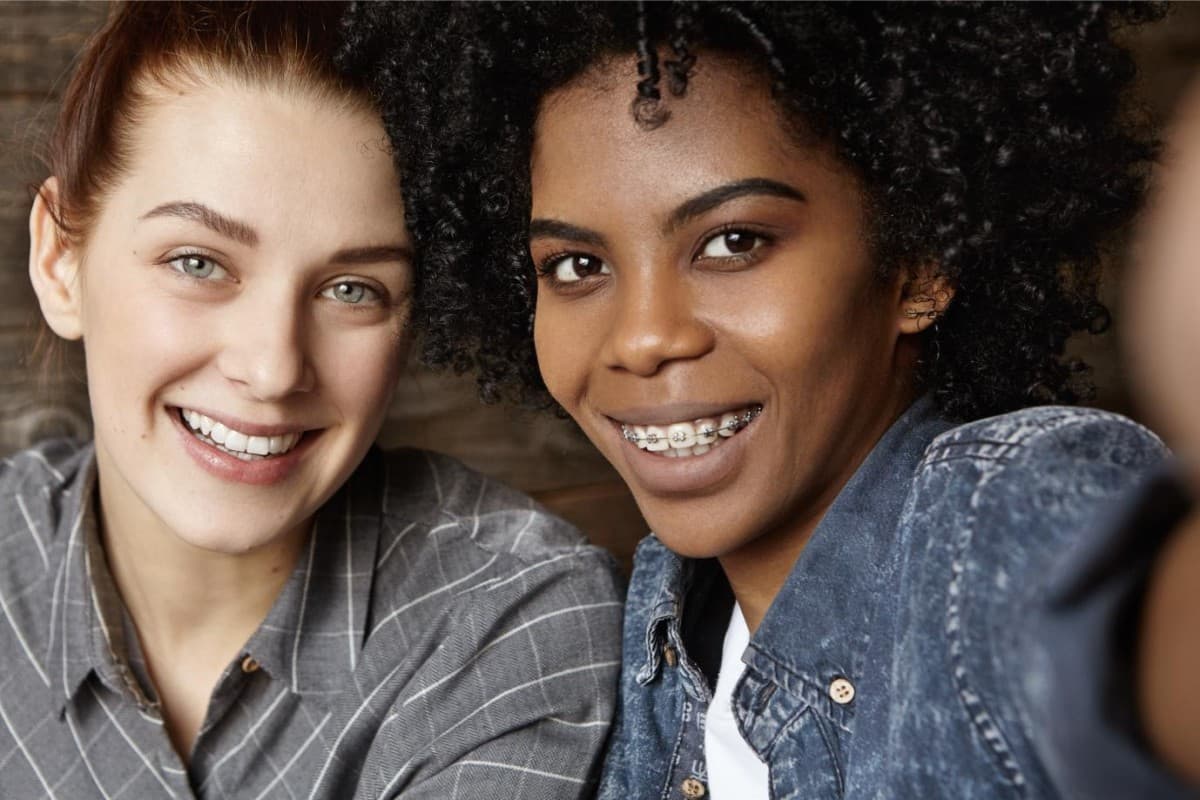 Seacoast Braces / Miller Orthodontics Now Sole Provider of Dynaflex Norris Passive Self-Ligating Brackets in Dover and Exeter, NH